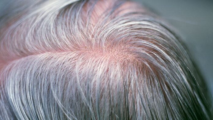 Top 4 reasons that lead to premature grey hair and how to prevent it -  Enigmatic Horizon